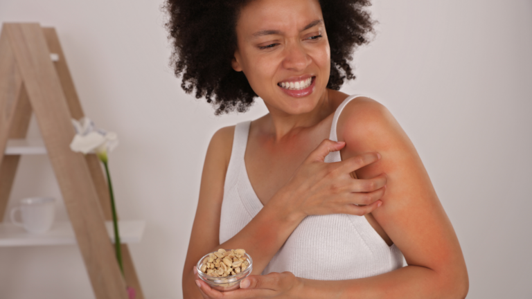 woman with food allergy